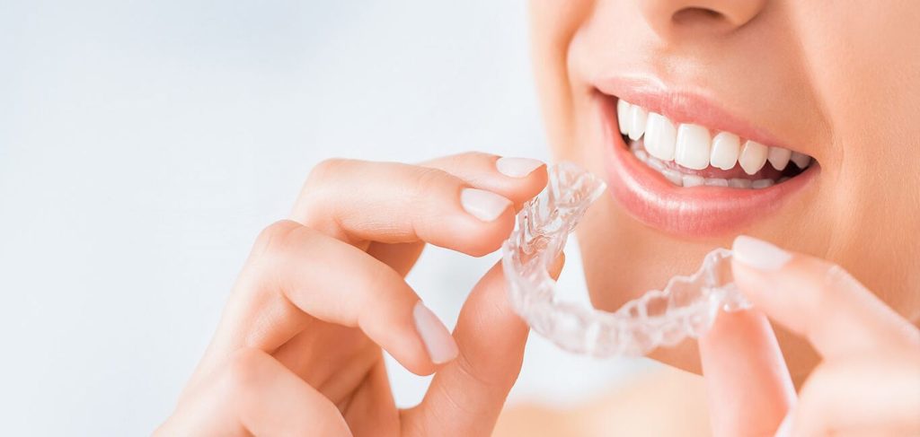 Maintain Oral Hygiene Using Invisalign Aligners