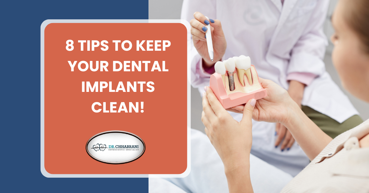 8 Incredible Tips to Keep Your Dental Implants Clean!