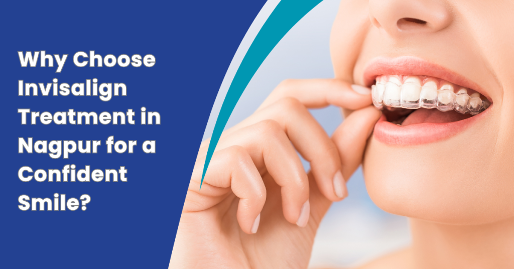 Invisalign Treatment in Nagpur